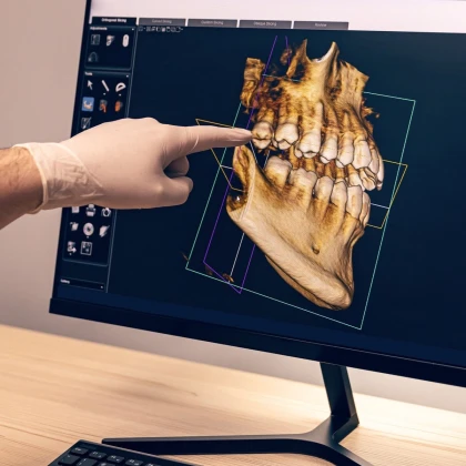 stomatologiya-dostupnih-tsen-tep-photo