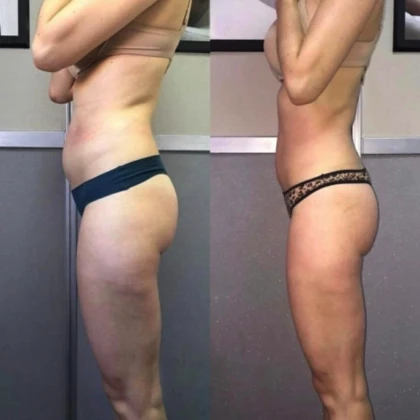 spetsialist-po-korrektsii-figuri-1-photo