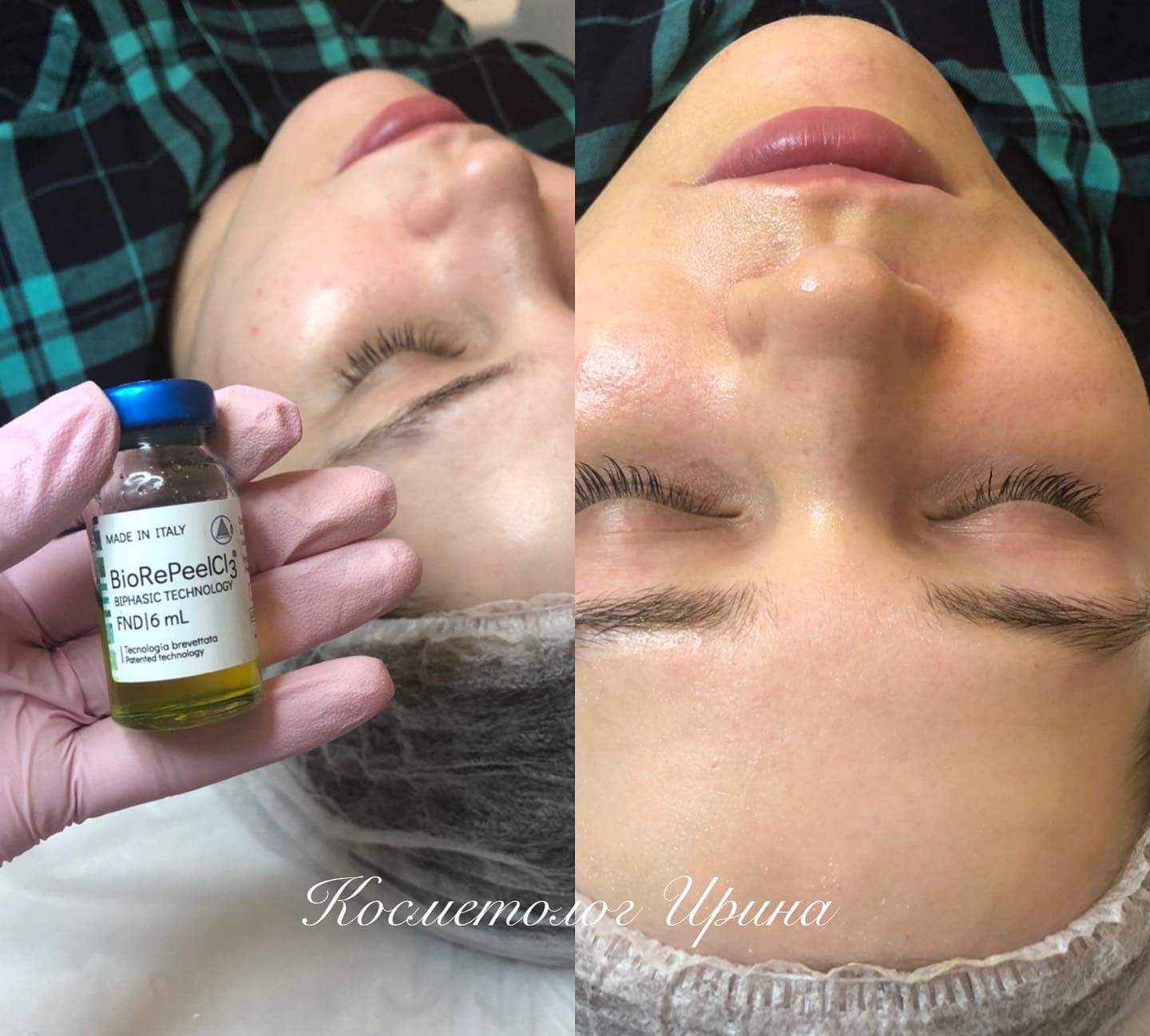 Irina Nadryan, Cosmetolog - Фото 4