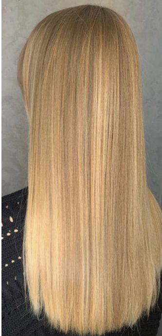 Tatyana, Hair Restoration - Фото 2