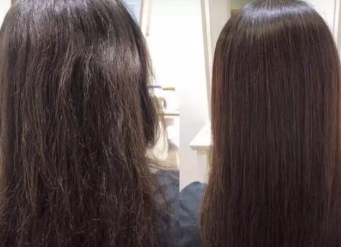 Tatyana, Hair Restoration - Фото 3