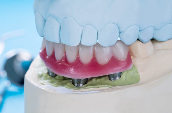 Cтоматологический Kабинет Bright Smile Dental - Фото 2