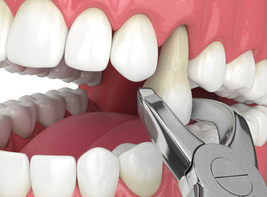 Cтоматологический Kабинет Bright Smile Dental - Фото 5