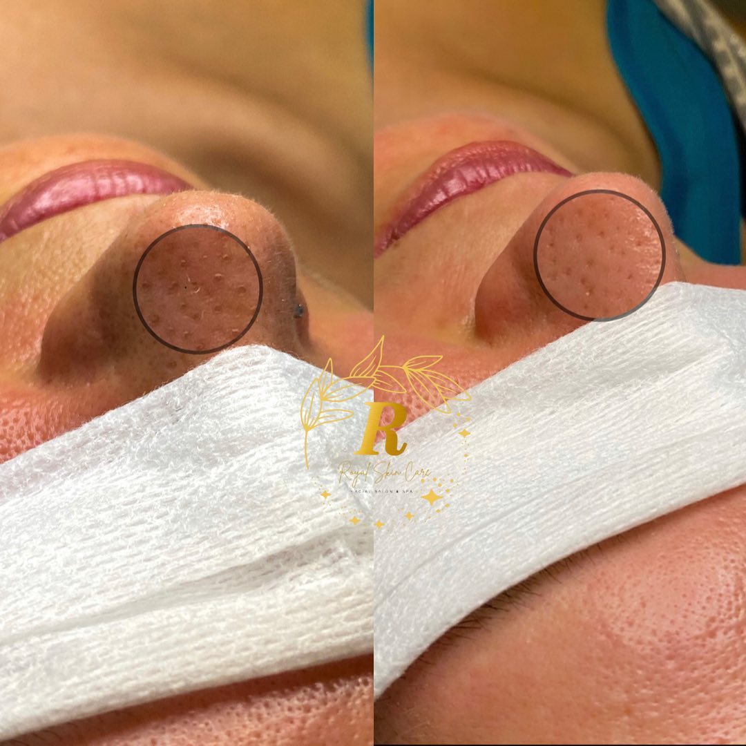 Royal Skin Care - Фото 2