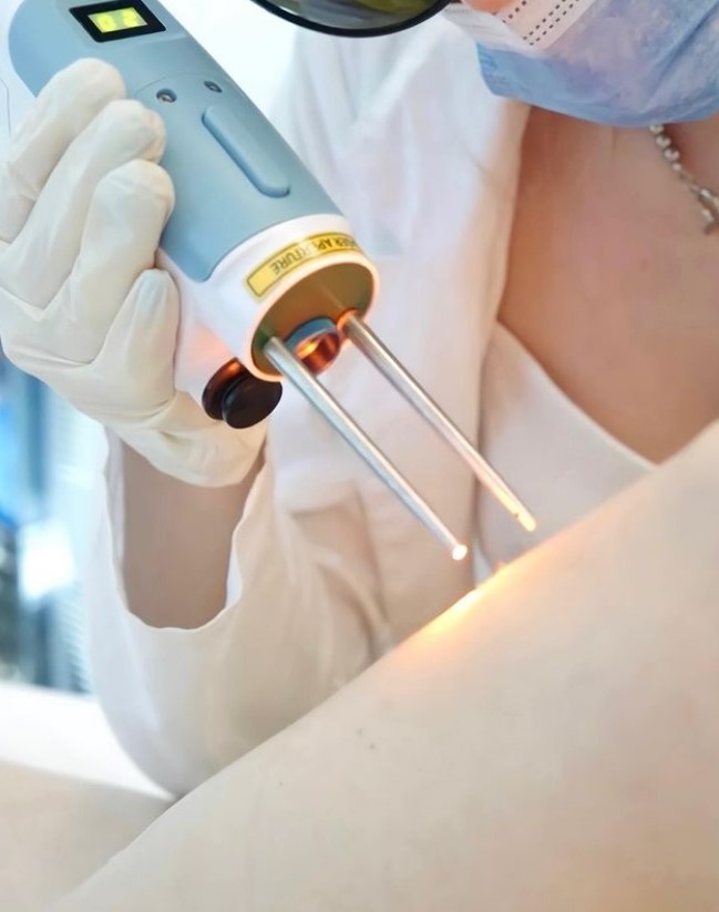 Laser and Spa - Laser Depilation - Фото 3