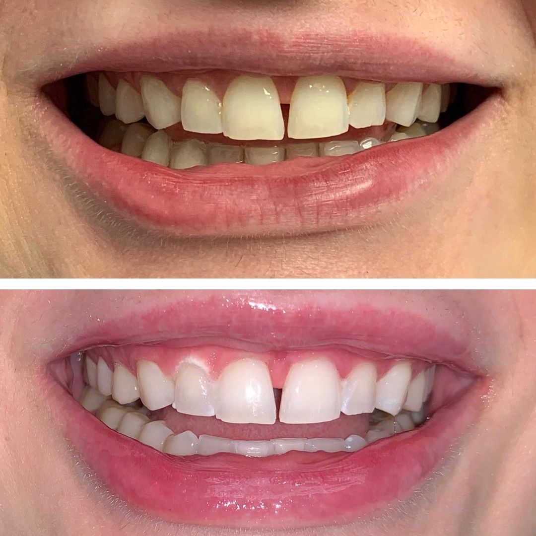 Aesthetic Dental Center of Bergen County - Фото 5