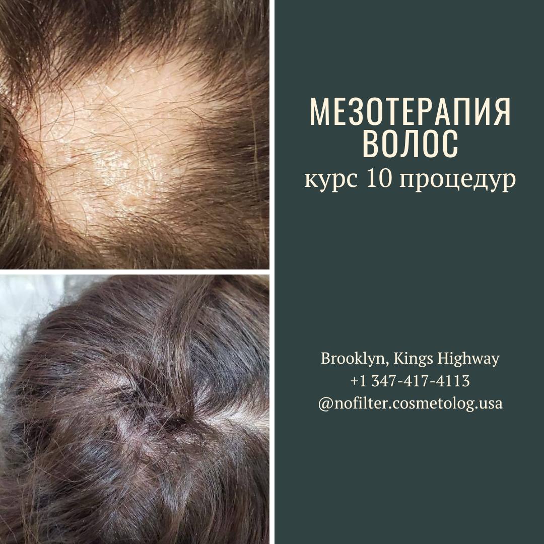 Косметолог с медицинским образованием и стажем работы в медицине. КОНСУЛЬТАЦИЯ БЕСПЛАТНАЯ! - Фото 3