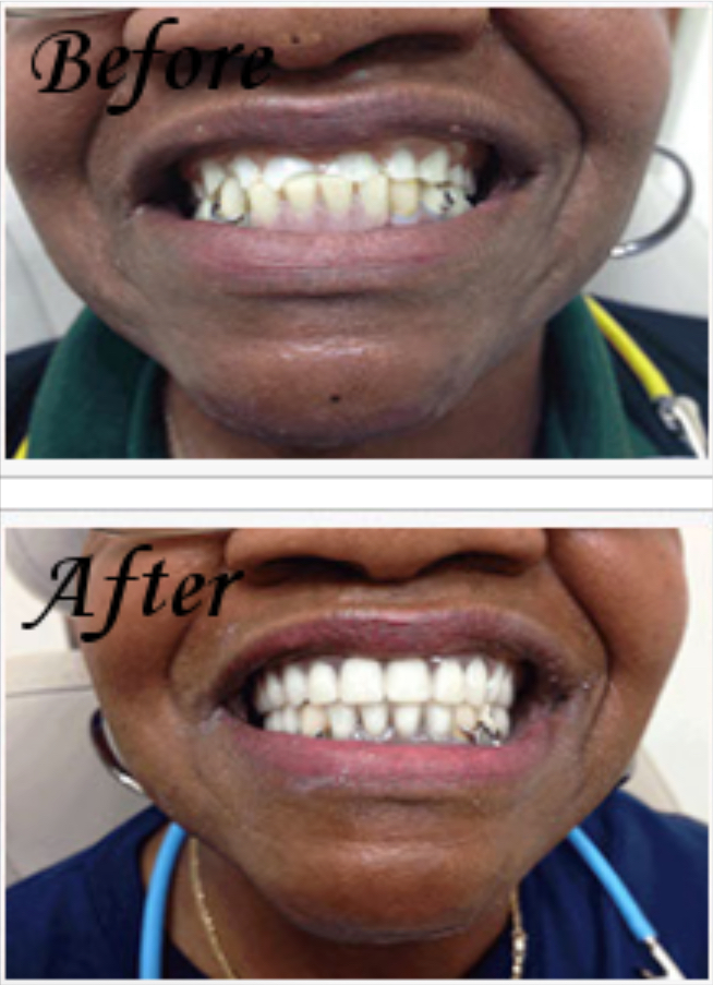 Accusmile Denture Clinic - Фото 2
