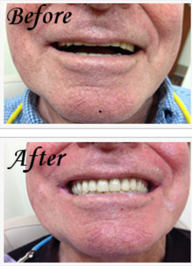 Accusmile Denture Clinic - Фото 3