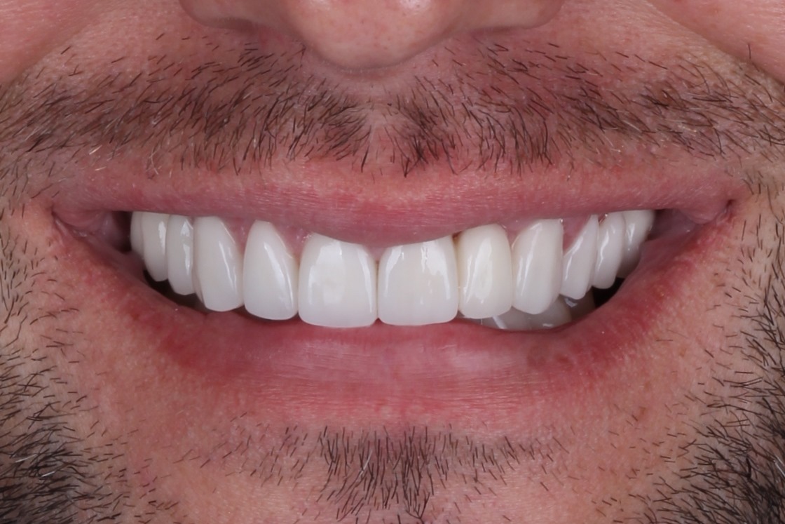 Major Dental Clinics - Zdjęcie 4