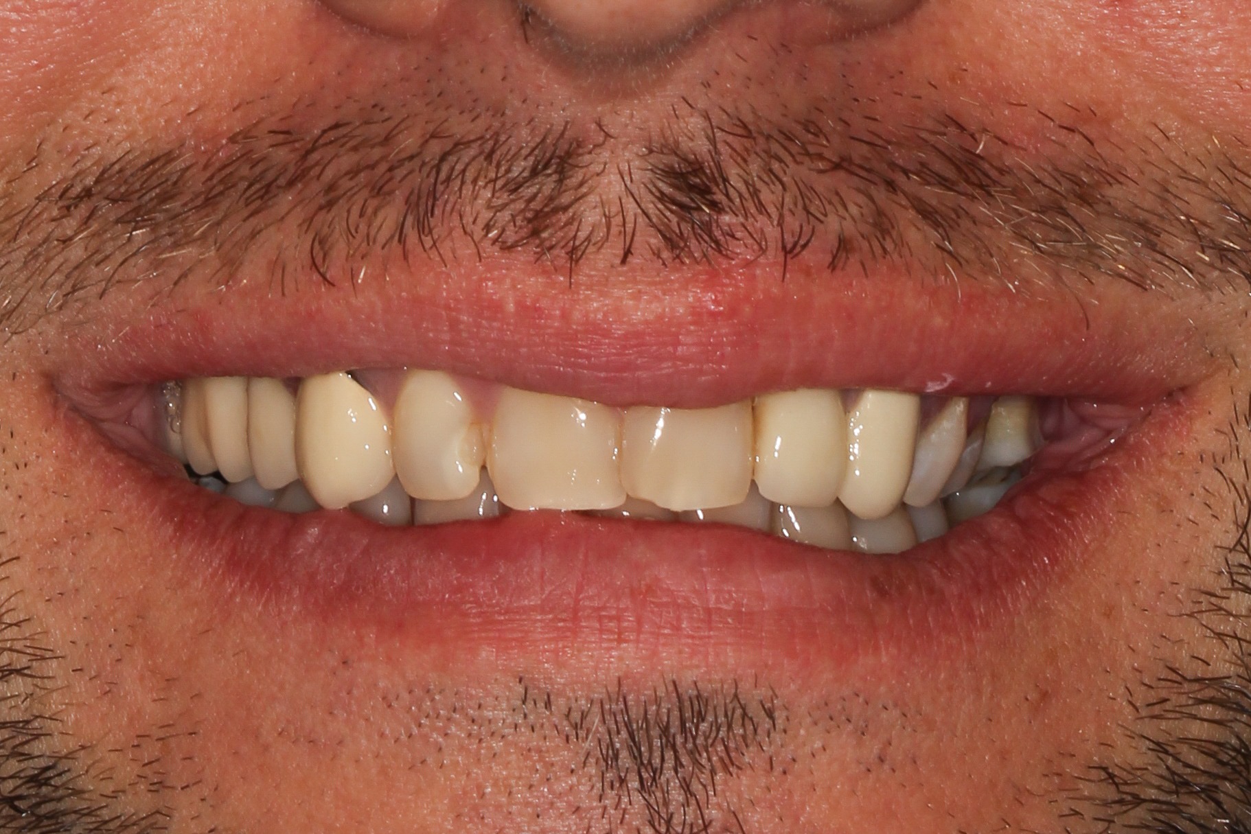 Major Dental Clinics - Zdjęcie 3