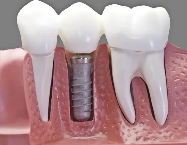 Family Dental Studio Pc - Zdjęcie 5