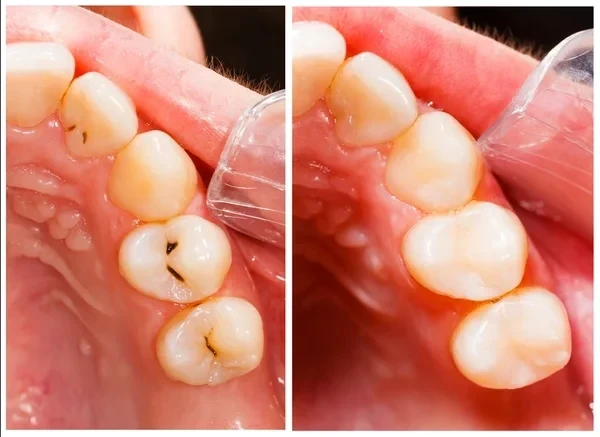Family Dental Studio Pc - Zdjęcie 4