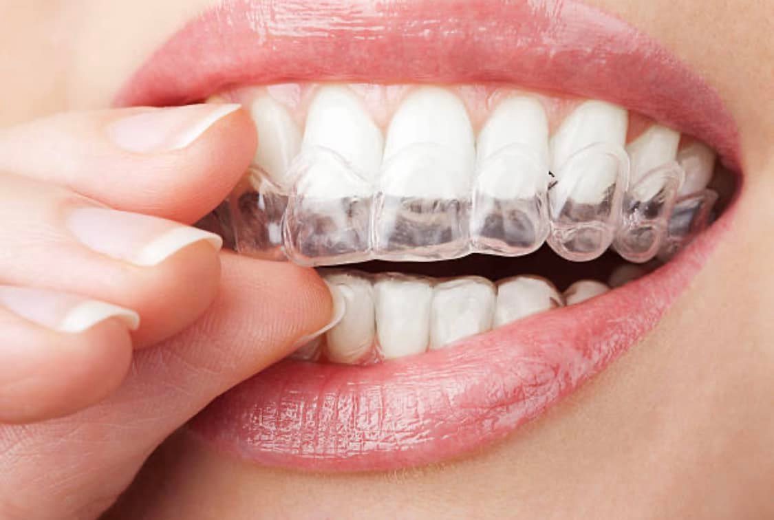Associates For Dental Care - Zdjęcie 2