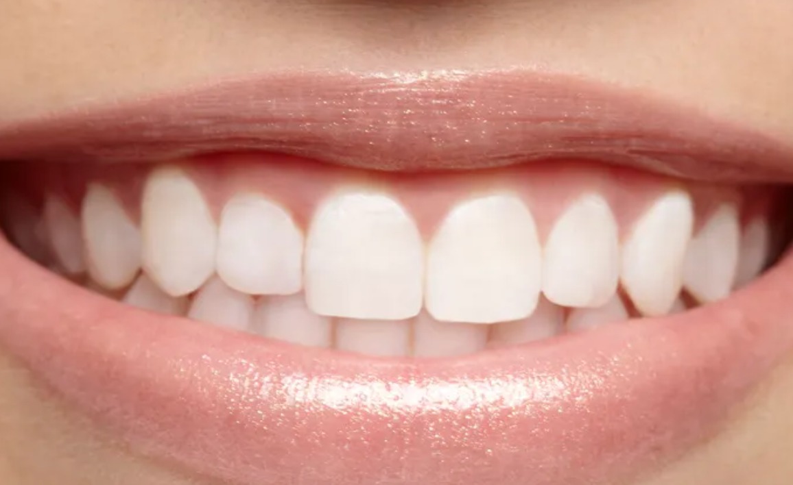 Associates For Dental Care - Zdjęcie 5