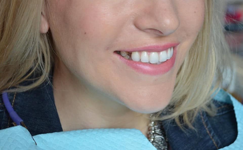 Simply Dental Implants - Zdjęcie 4