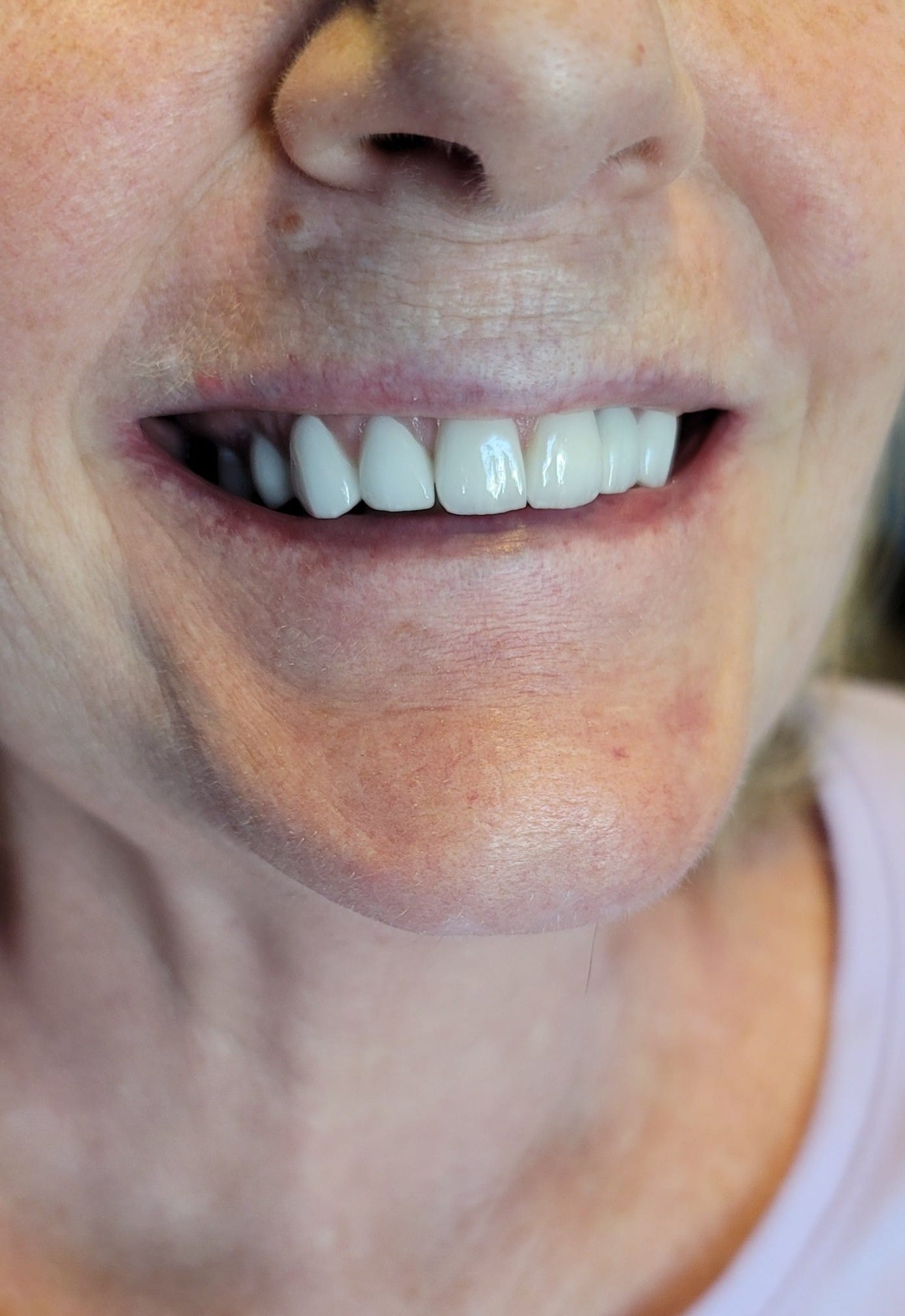 Simply Dental Implants - Zdjęcie 5