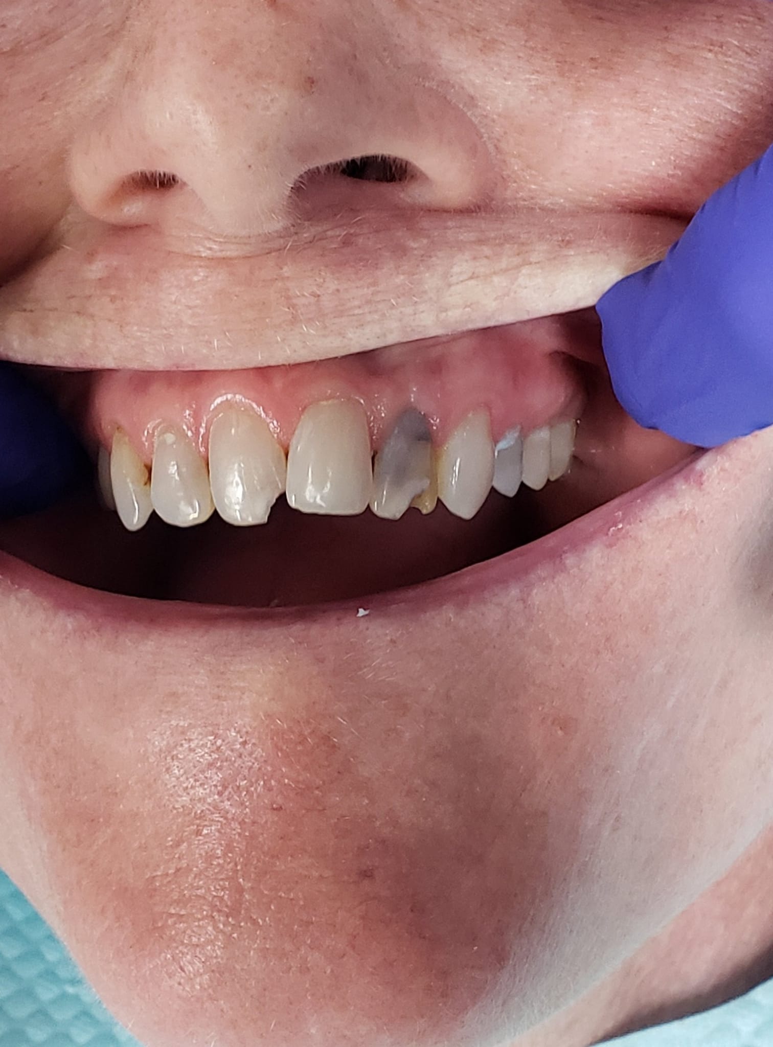 Simply Dental Implants - Zdjęcie 6