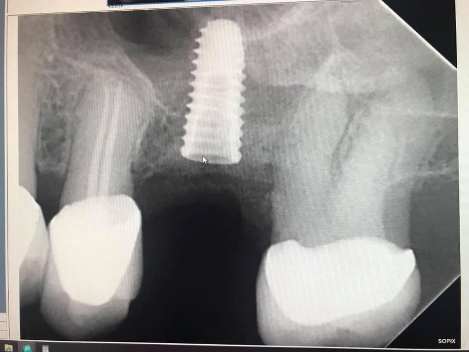 Lanson Dental P.C. - Zdjęcie 4