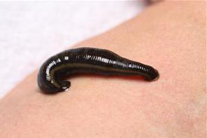 BK Holistiks-Leech Theraphy - Zdjęcie 3