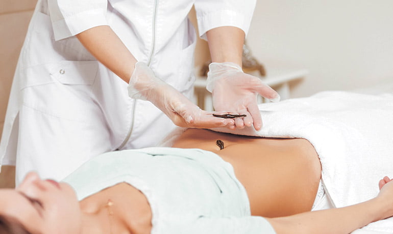 BK Holistiks-Leech Theraphy - Zdjęcie 5