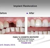 ELMHURST DENTAL ARTS - Zdjęcie 3