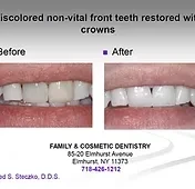 ELMHURST DENTAL ARTS - Zdjęcie 4