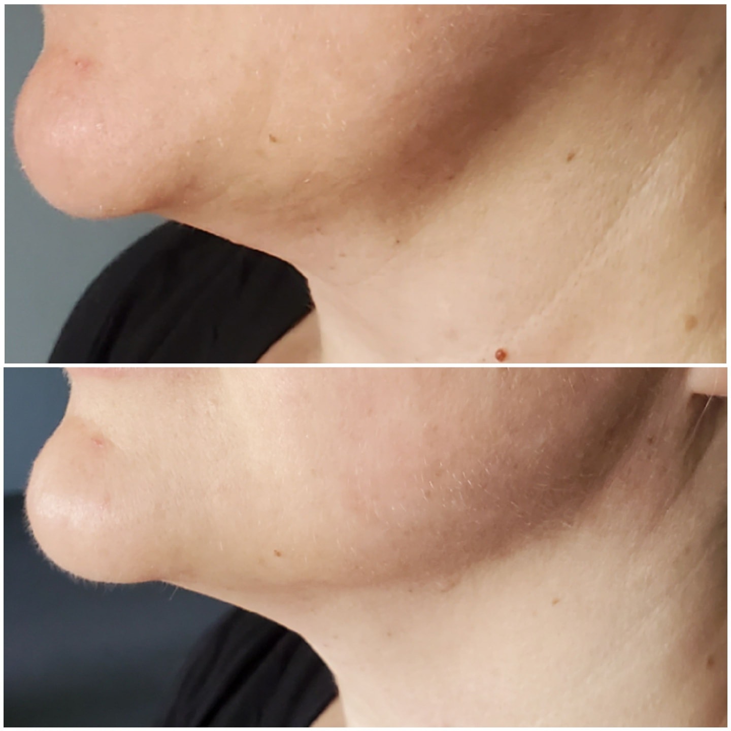 Mila Esthetician - Kosmetyczka Mariola - Zdjęcie 4