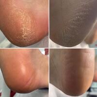 Manicure pedicure leczniczy / Depilacja /Laminowanie rzęs - Zdjęcie 6