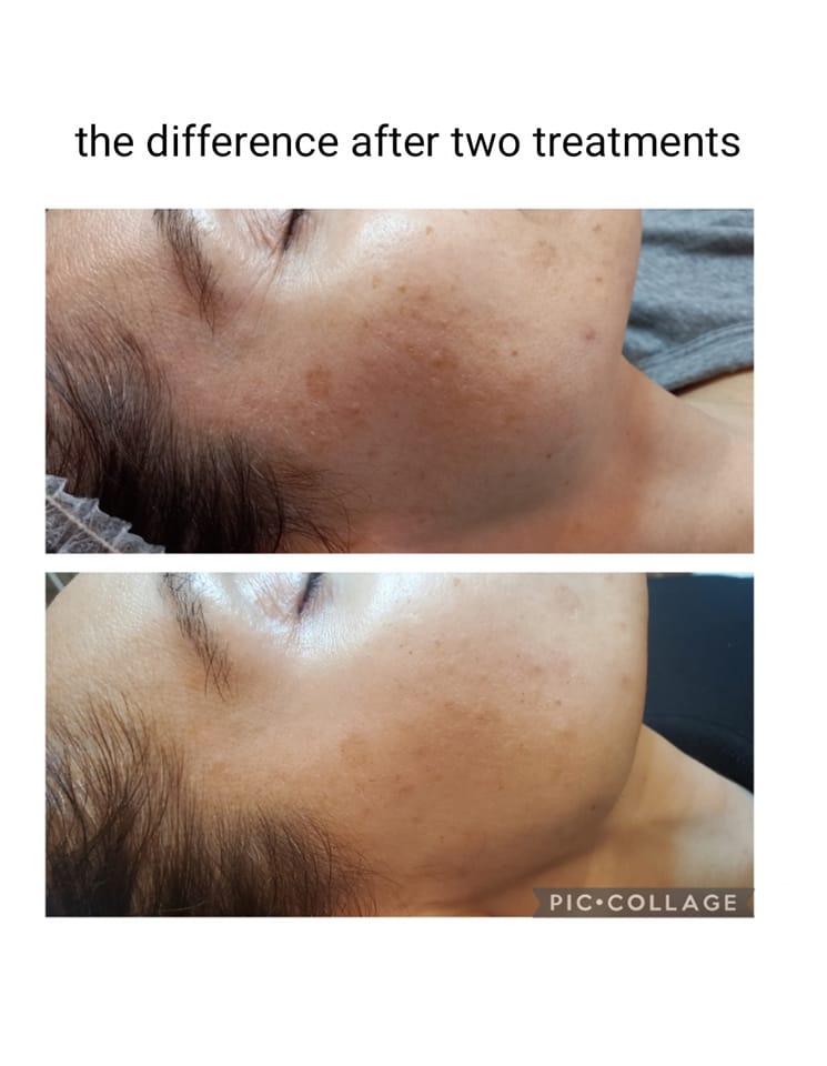 ShineAgain Beauty Clinique - Zdjęcie 2