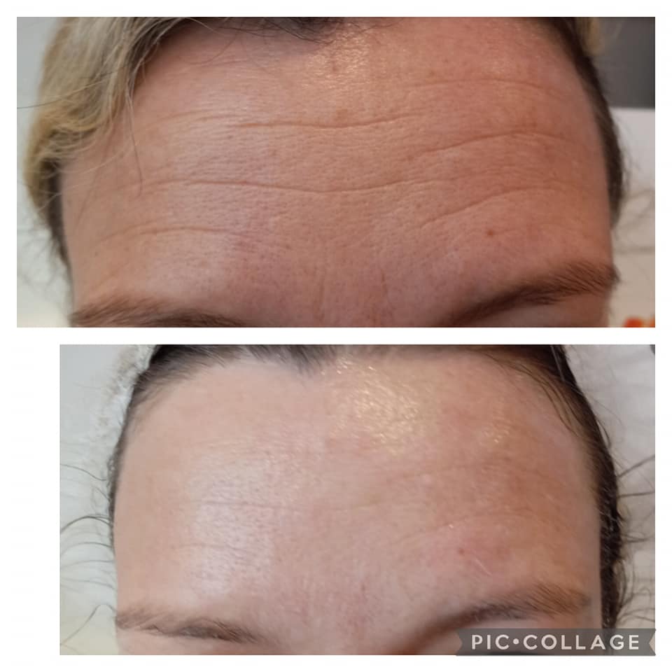 ShineAgain Beauty Clinique - Zdjęcie 6