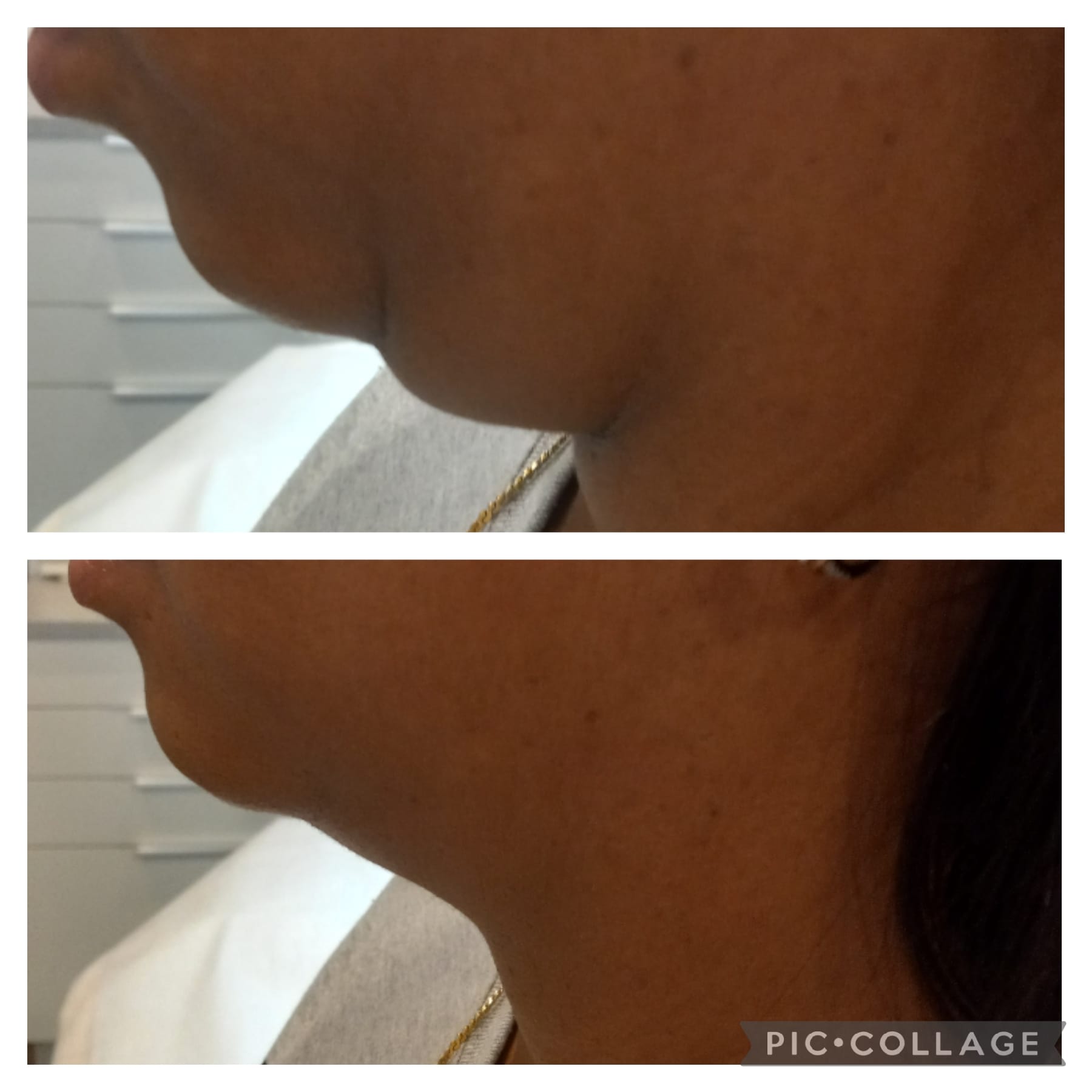 ShineAgain Beauty Clinique - Zdjęcie 4