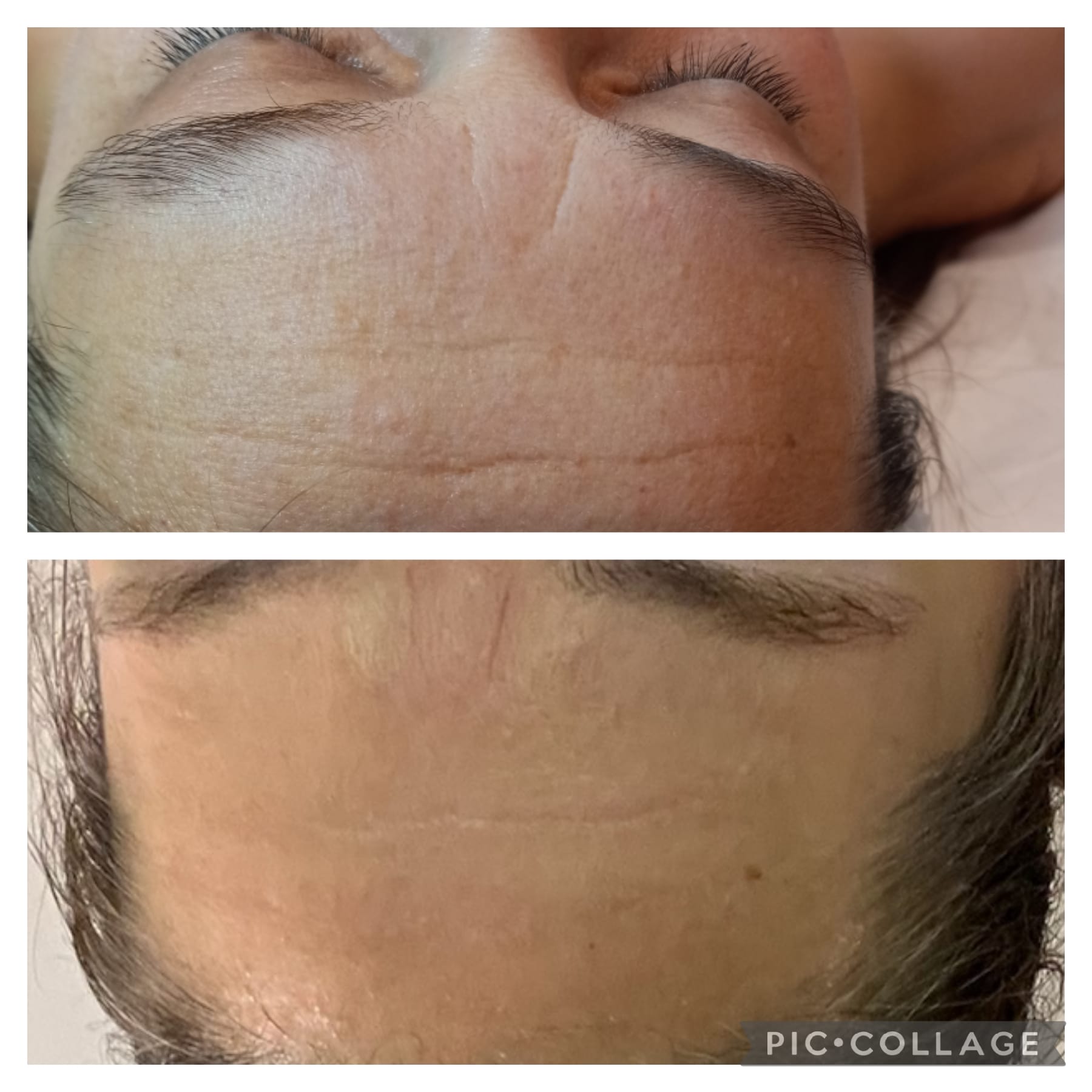 ShineAgain Beauty Clinique - Zdjęcie 3