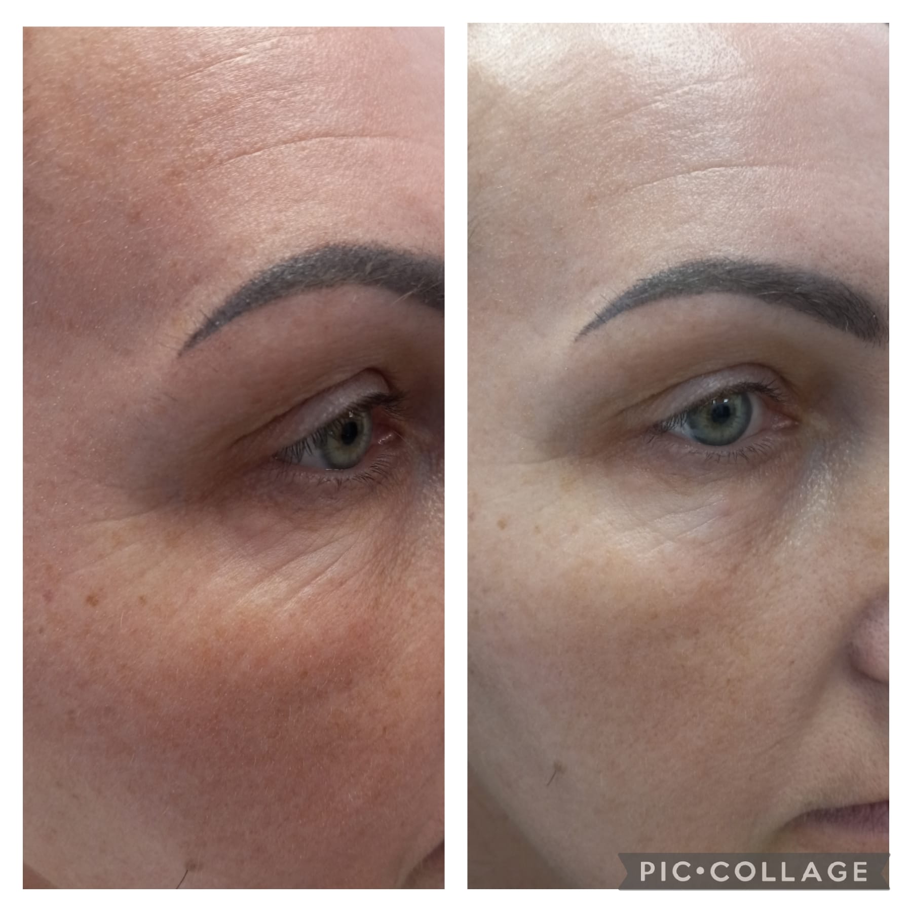 ShineAgain Beauty Clinique - Zdjęcie 5