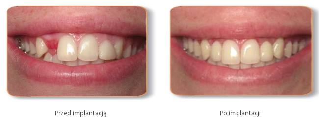 Metropolitan Dental - Zdjęcie 3