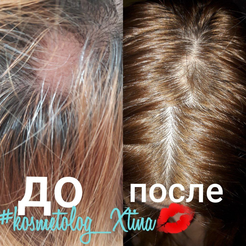 Христина, Косметолог - Фото 5