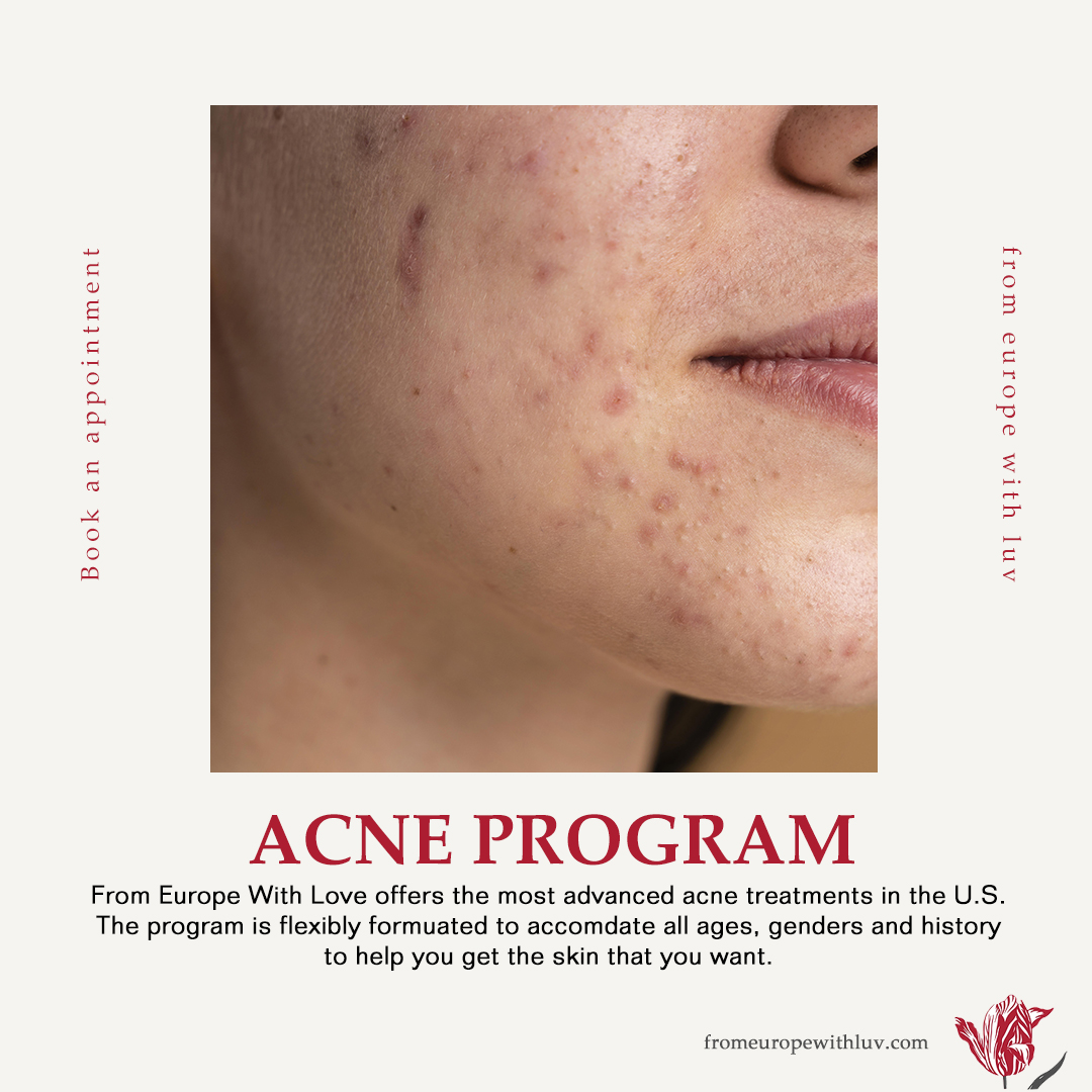 From Europe With Love Skin Care Clinic - Фото 2