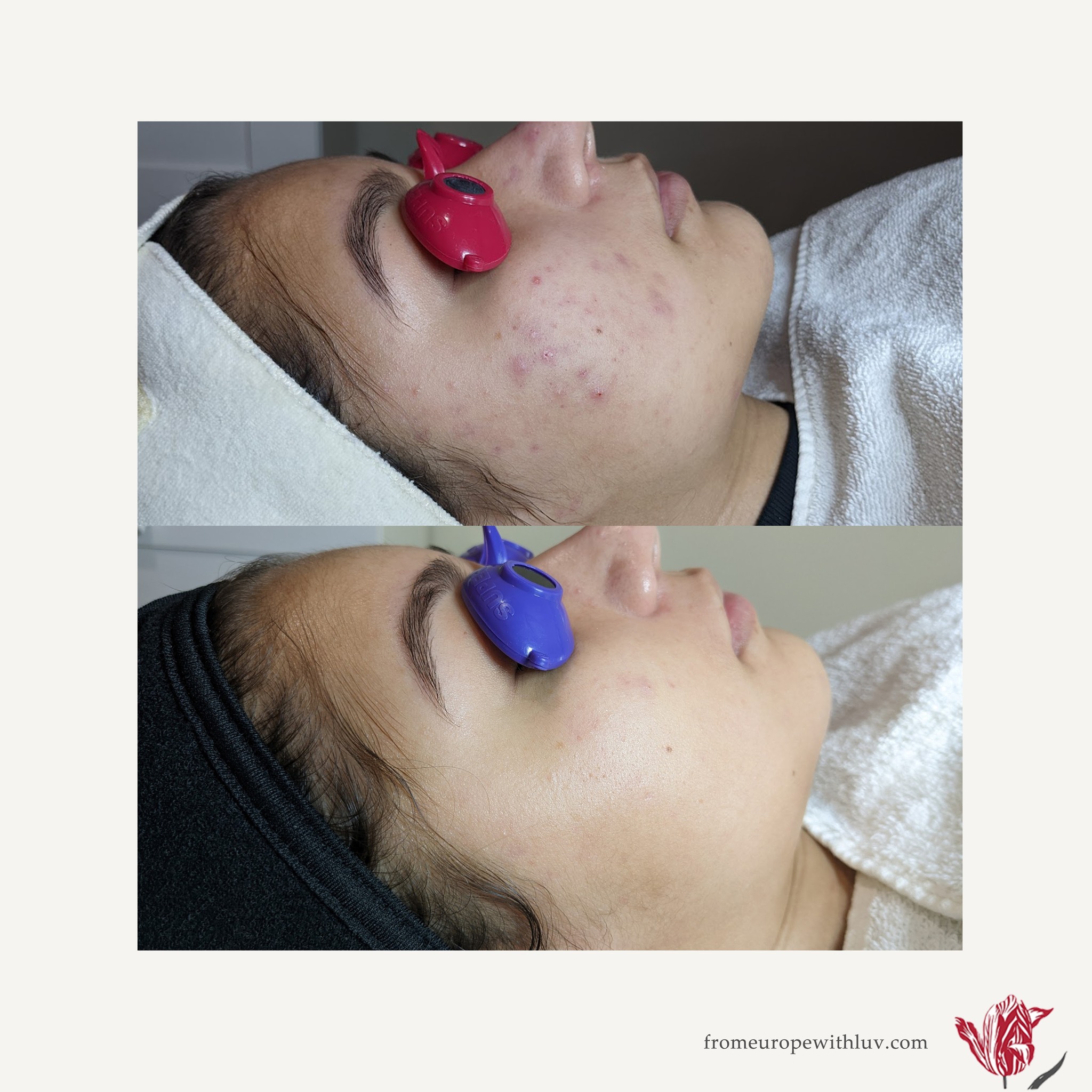 From Europe With Love Skin Care Clinic - Фото 3