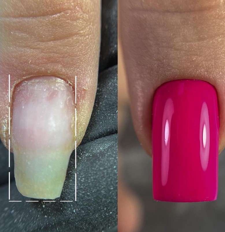Nail Technician - Фото 7
