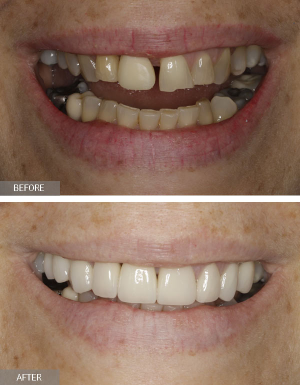 NYC Dental Implants Center - Фото 7