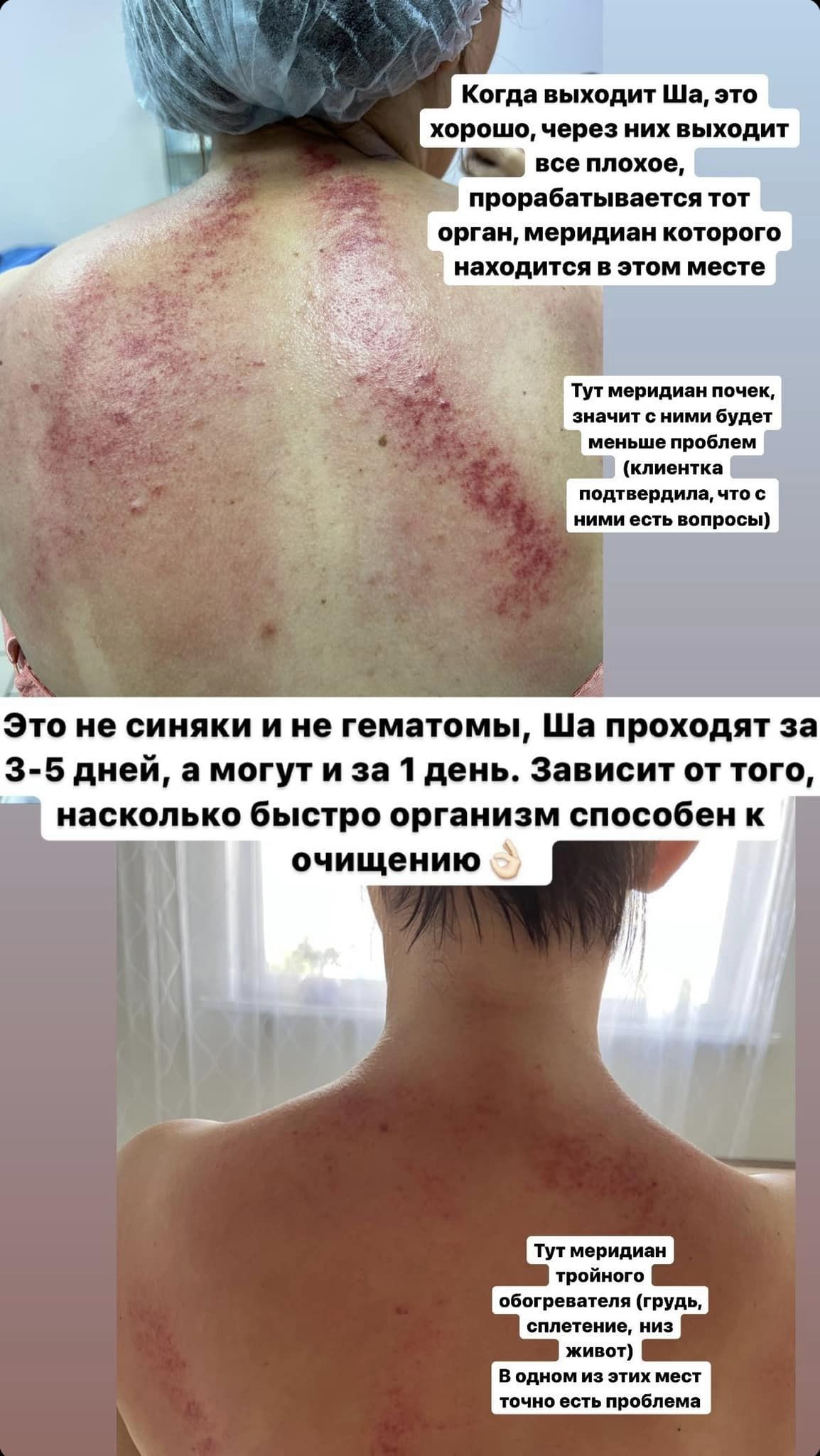 Массаж ГУАША и Другие Виды Массажа - Фото 4