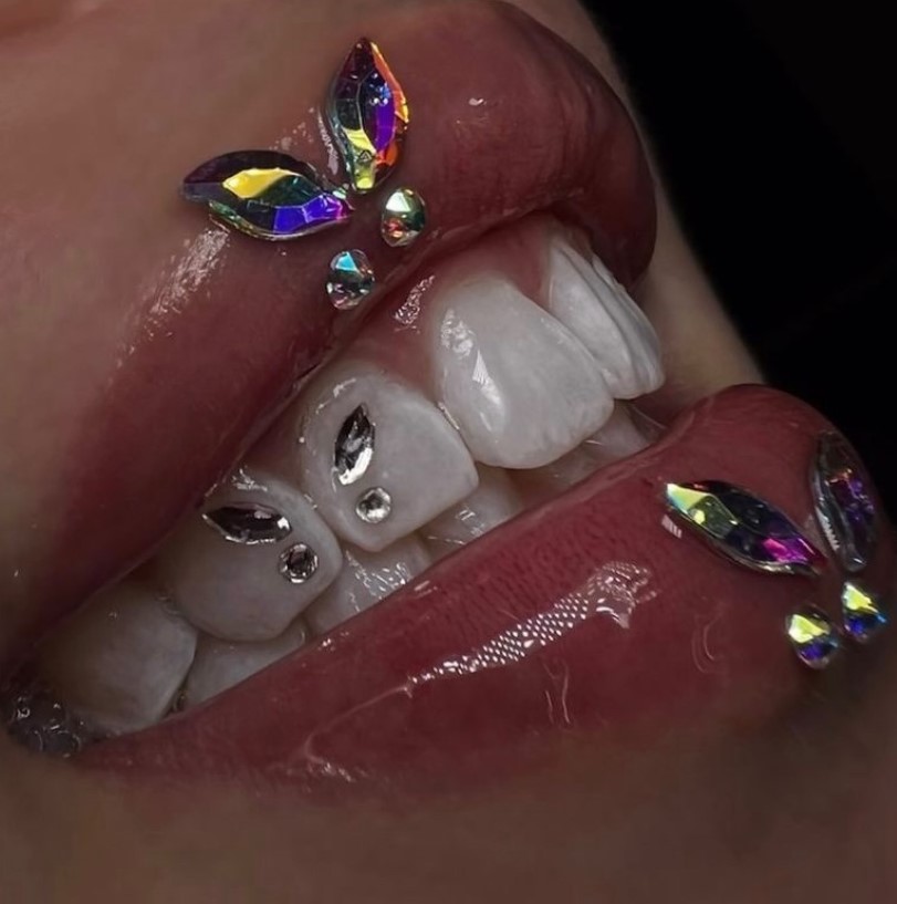 Tooth Gems - Фото 2