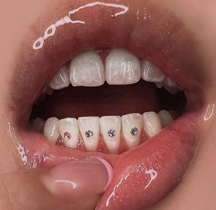 Tooth Gems - Фото 5