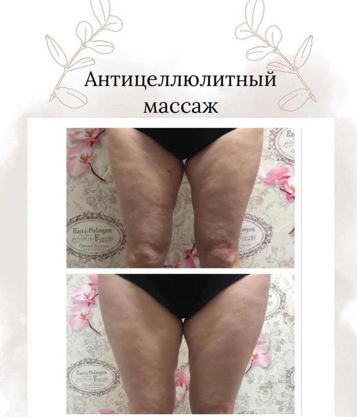 Victoria Pikina - Masseur - Фотографія 6