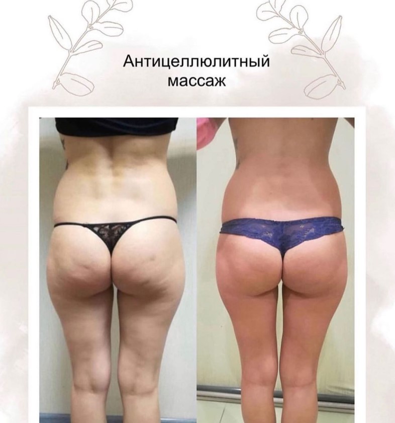 Victoria Pikina - Masseur - Фотографія 5