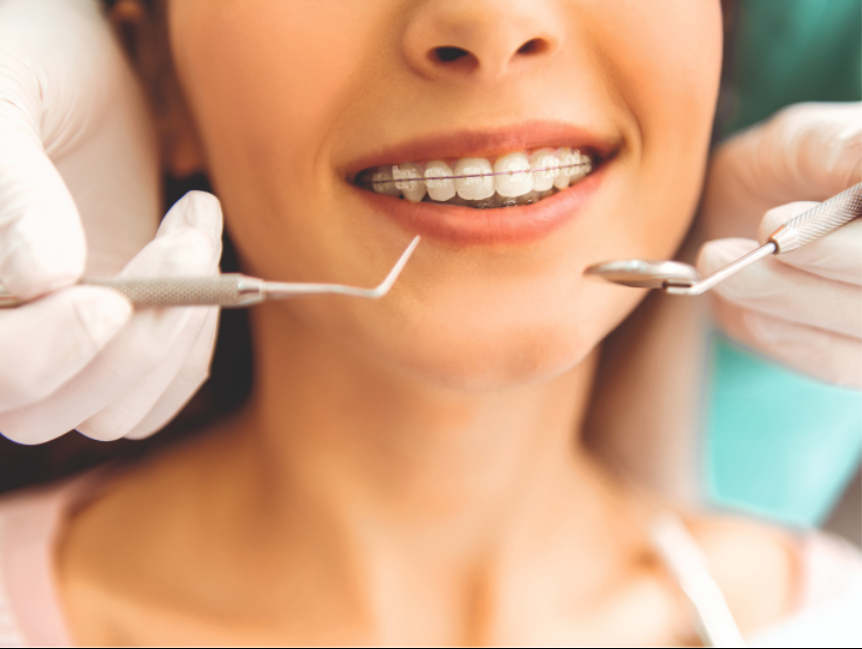 Miracle Dental Center - весь спектр услуг современной стоматологии! - Фото 13