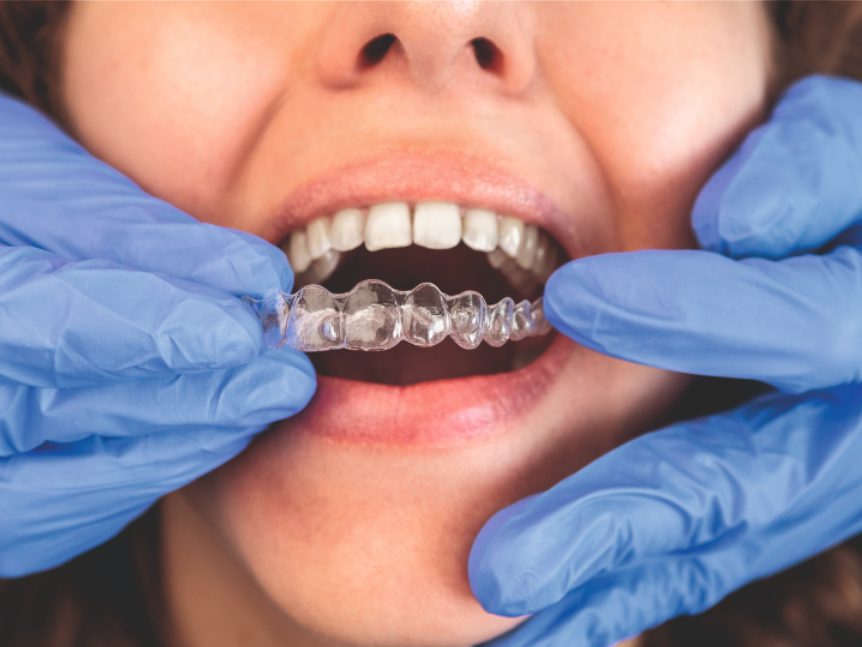 Miracle Dental Center - весь спектр услуг современной стоматологии! - Фото 15
