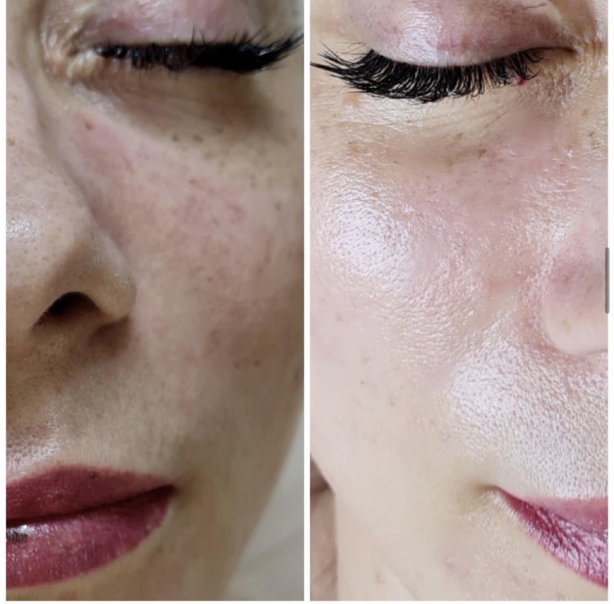 Svetlana, Cosmetologist and Dermatologist - Фото 3