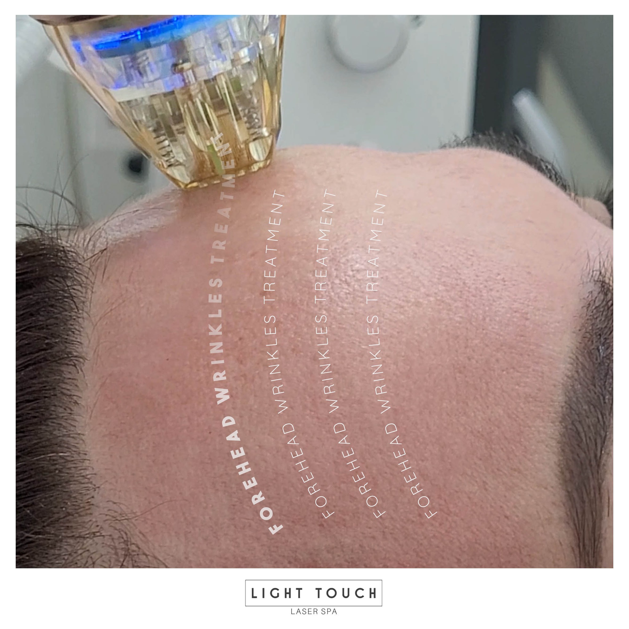Light Touch Laser Spa - Фото 3