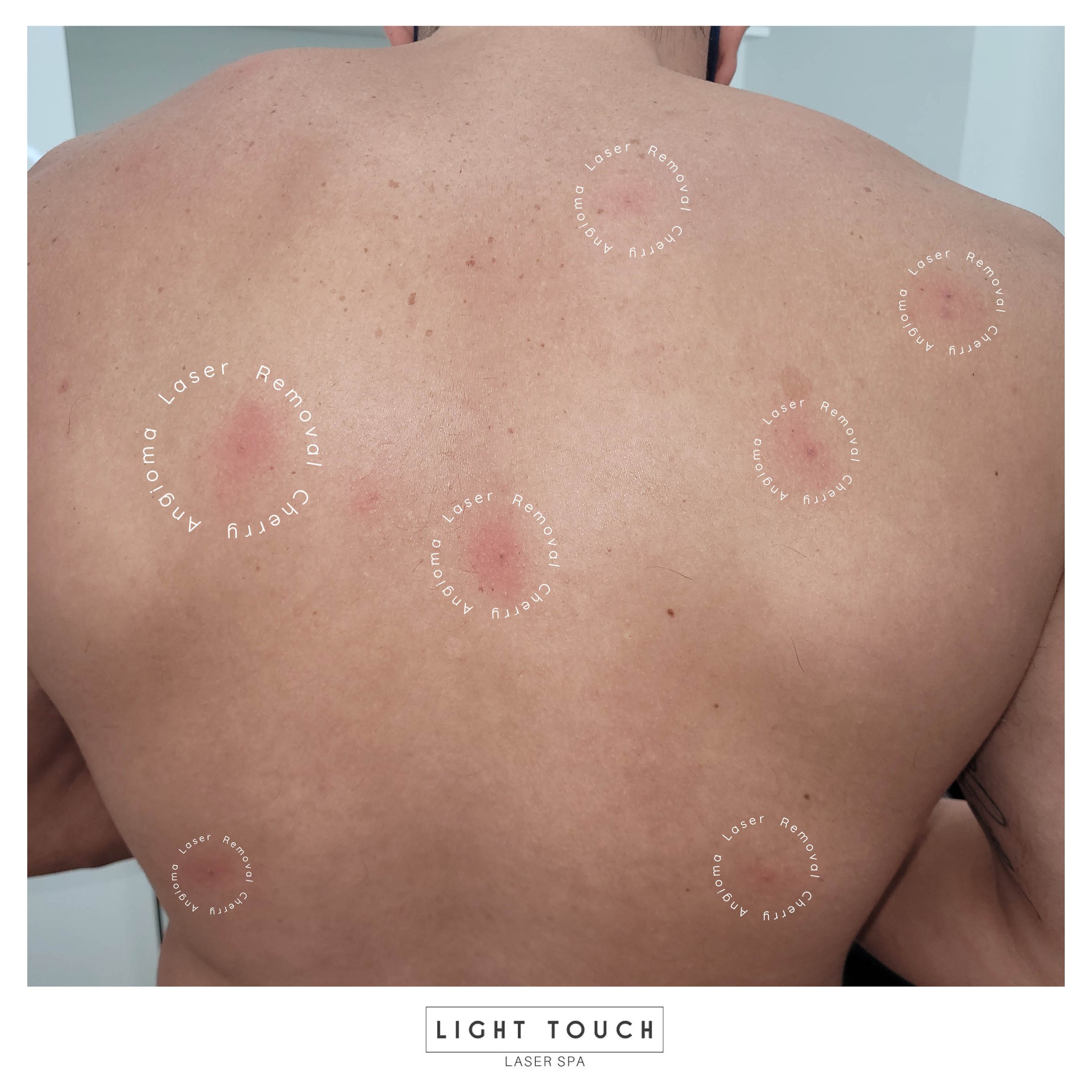 Light Touch Laser Spa - Фото 4